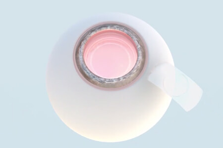 PRL手術(shù)是什么意思？